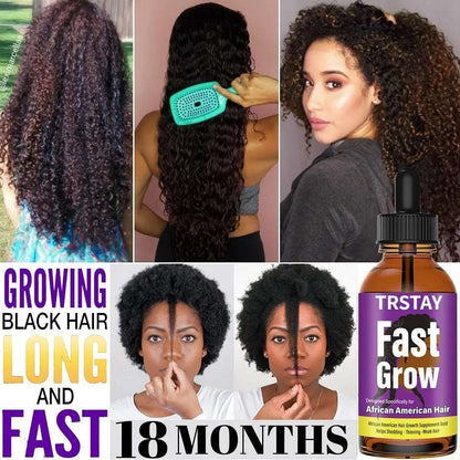 Anti Alopecia Oil Hair Growth Essential Oils Essence Anti-Hair Loss Hair