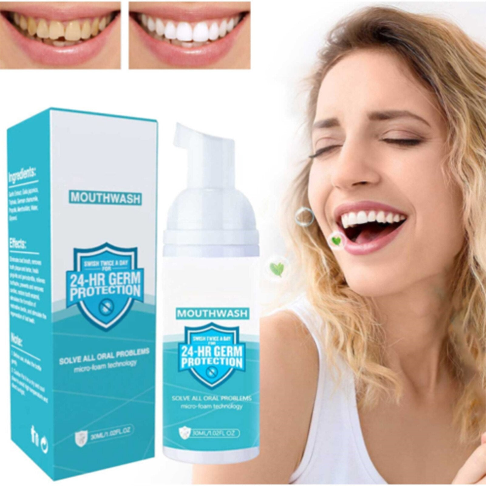 Teeth whitening