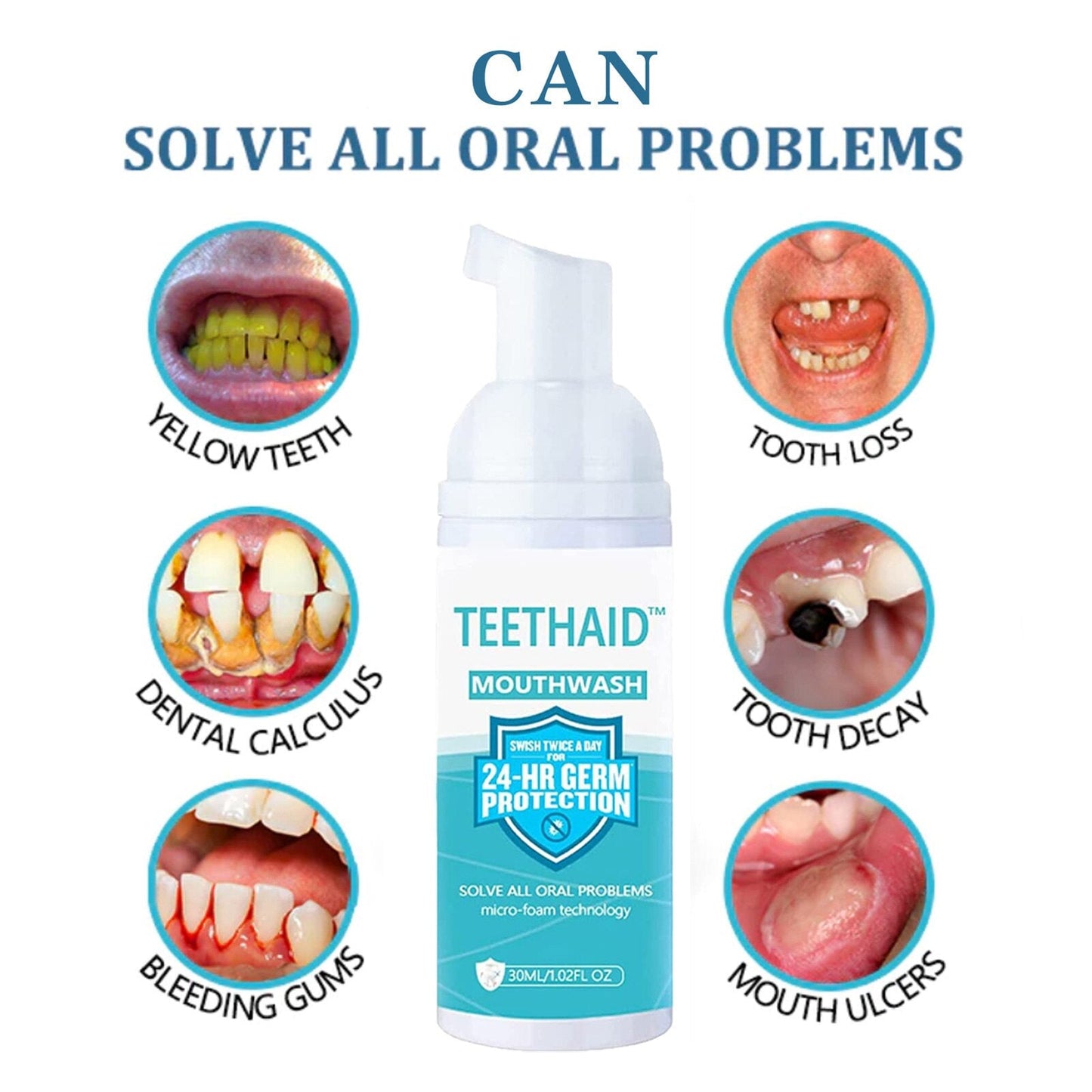 Teeth whitening